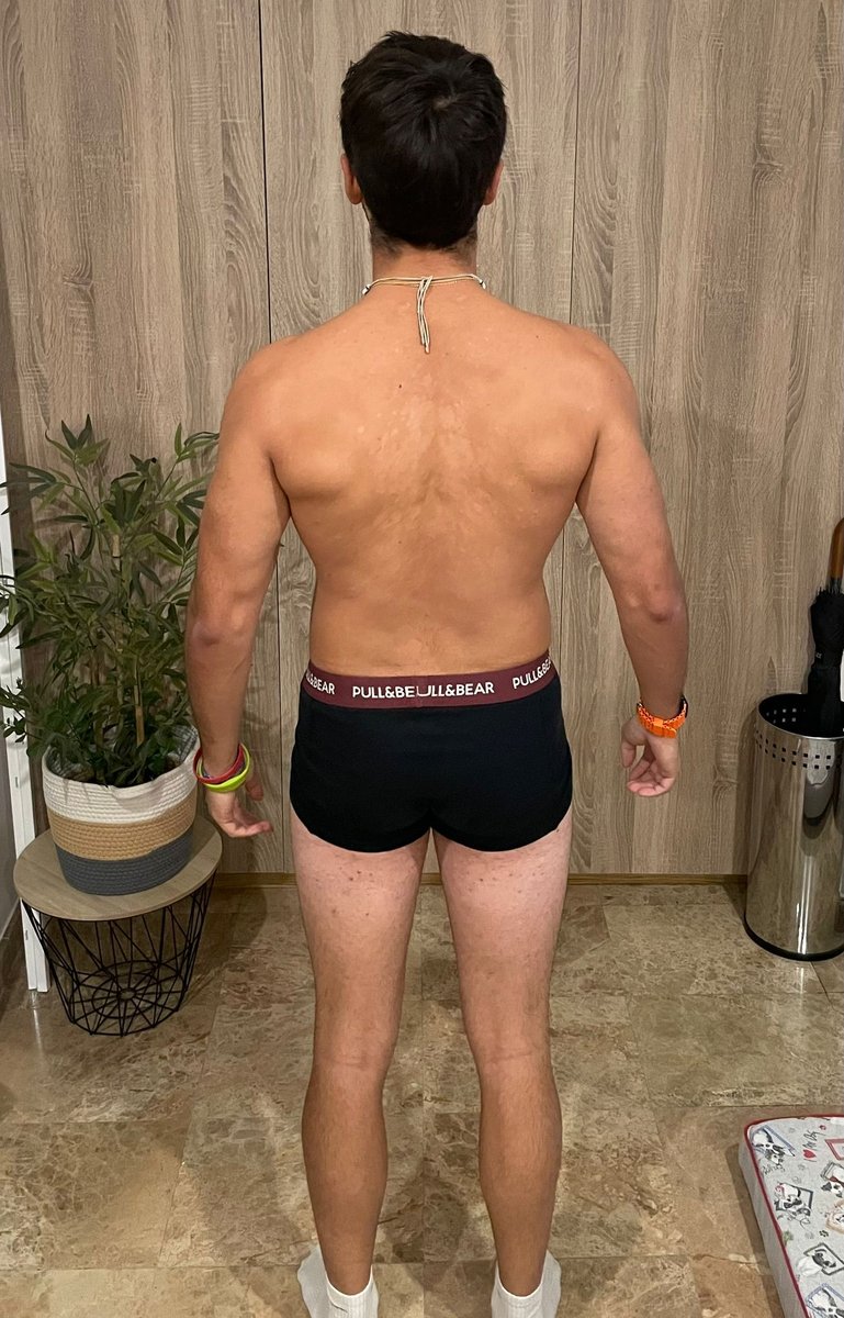 Carlos before
